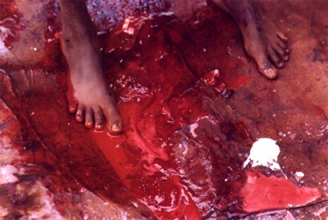 A girl bleeds from ritual cutting (FGM)