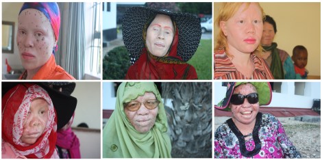 Top row: (l to r) Grace Medaldi, Janet Anatoli, Judicka Lyamboko Bottom row: Shamira, Zaidai Nsembo, Zakkiyah Matimbwa. Albino women from Tanzania. Photos taken in October 2013 in Dar es Salaam and Moshi, Tanzania by Chika Oduah